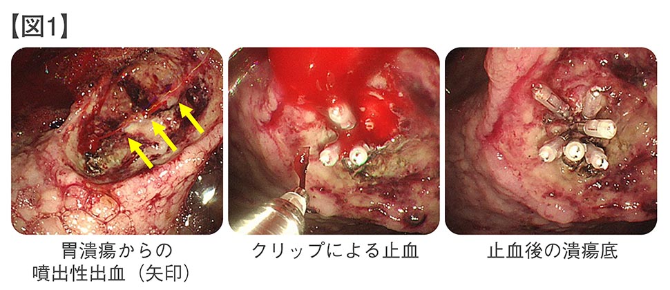 gastroenterology1