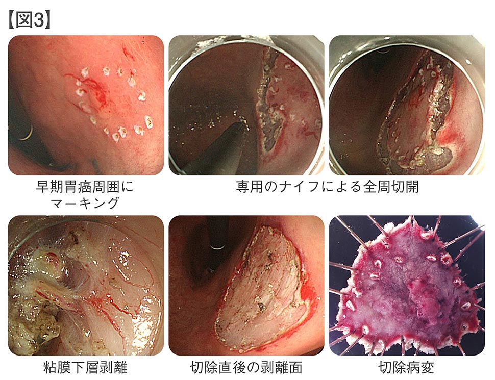 gastroenterology3