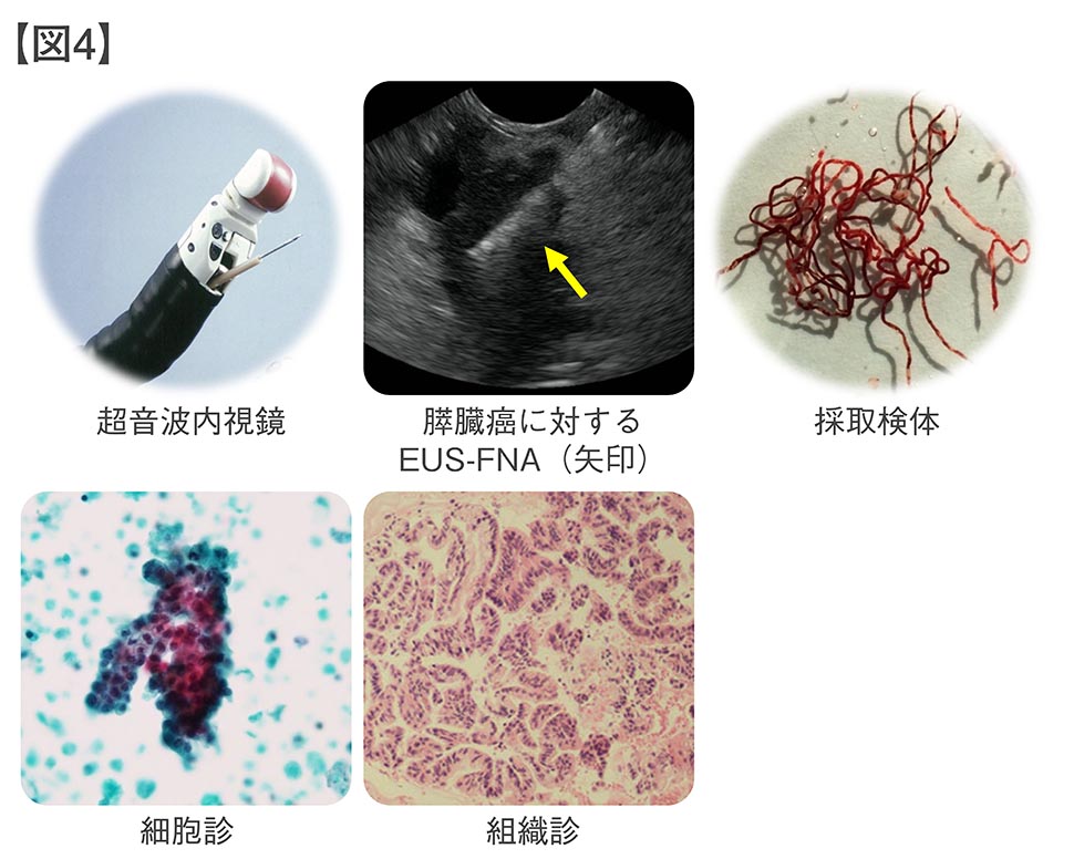 gastroenterology4