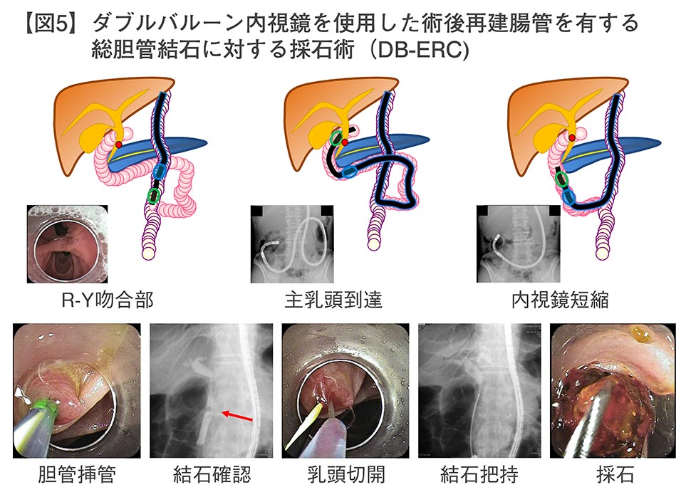 gastroenterology5